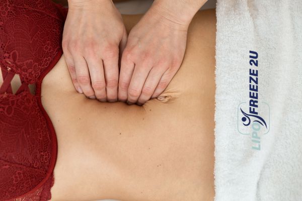 diastasis recti treatment Sandbach