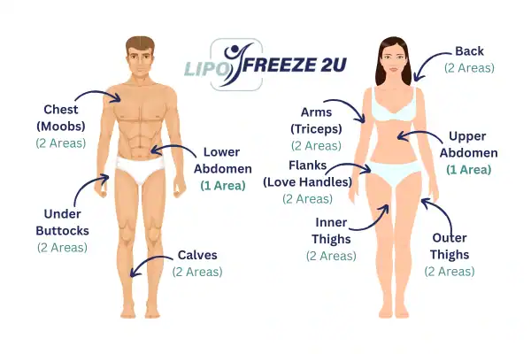 Areas you can have fat freezing treatment Sandbach