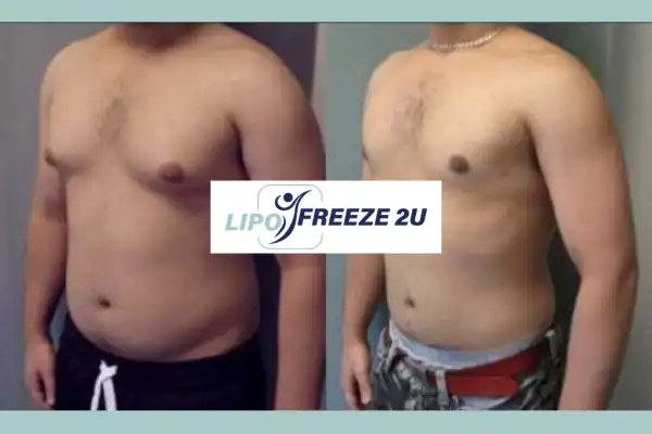 How Long Does It Take to See Results Sandbach?