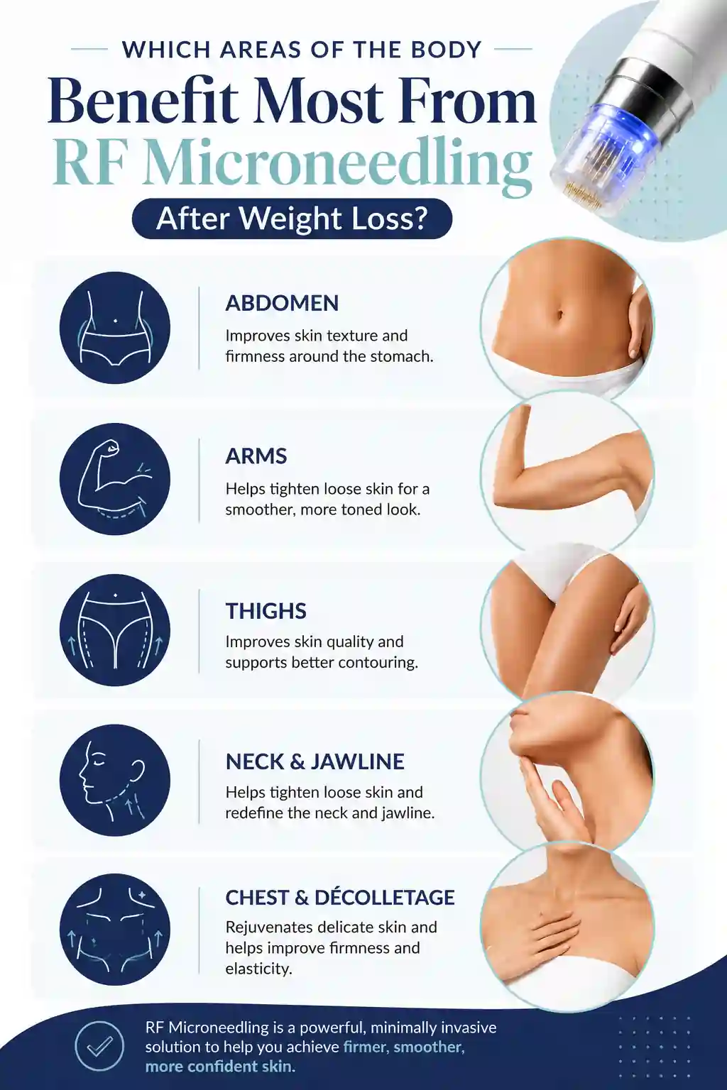 Which Areas of the Body Benefit Most From RF Microneedling After Weight Loss Sandbach